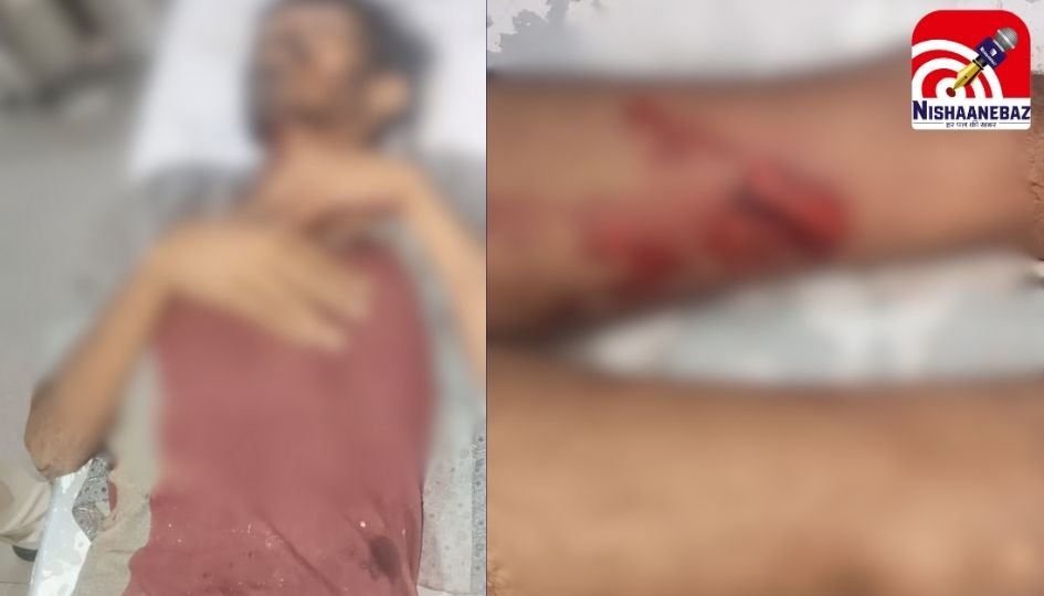 Shajapur News : ट्रक और डंपर की जोरदार भिड़ंत, एक सवार घायल…..