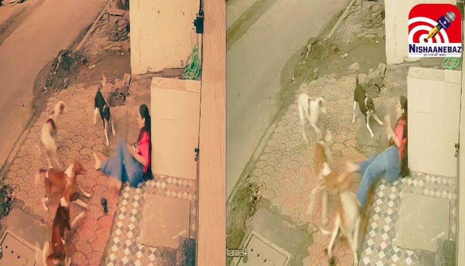 Indore News : छात्रा पर स्ट्रे डॉग्स का कहर