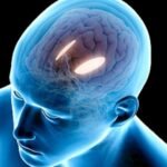 Migraine Therapy
