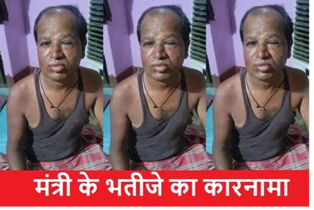 CG NEWS : ‘मेरे चाचा मंत्री हैं’… छत्तीसगढ़ में राजस्व मंत्री के भतीजे पर पेट्रोल पंप सुपरवाइजर से मारपीट का आरोप, कांग्रेस बोली- पुलिस ने लूट की धारा नहीं जोड़ी