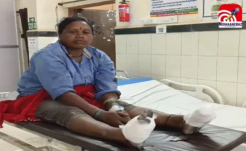 Balod Factory Accident : ईंट फैक्ट्री में दर्दनाक हादसा : महिला के दोनों पैर फैक्चर, उंगलियां कटीं