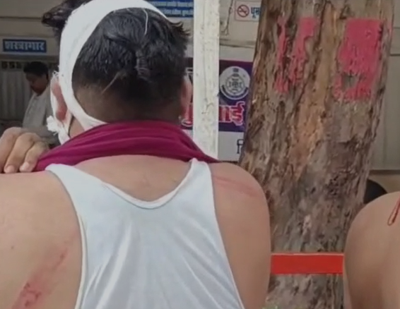 Tikamgarh News: डॉक्टर के कर्मचारियों ने मरीज और परिजनों को लाठी-डंडों से पीटा, CCTV में कैद हुई वारदात