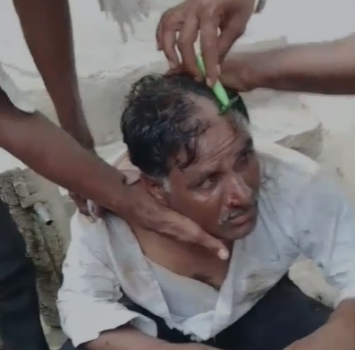Shajapur Crime : शाजापुर में ग्रामीणों ने युवक को दी तालिबानी सजा, मारपीट कर उस्तरे से काटे बाल-मूंछ, देखें वीडियो