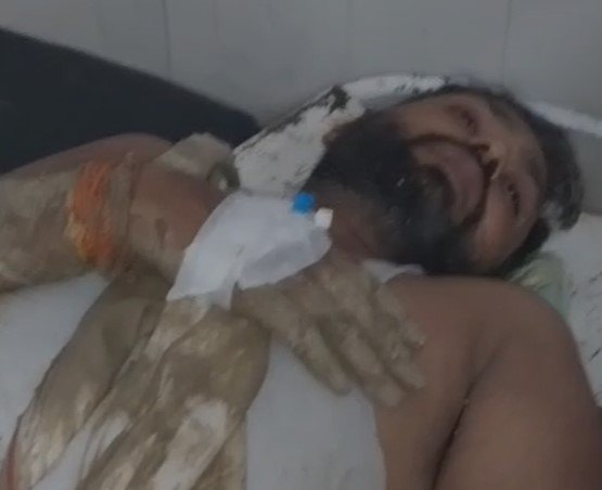 Gwalior News: ज़मीन विवाद में खूनी संघर्ष, लाठी-डंडों से पीटकर चार लोग घायल, आरोपी फरार