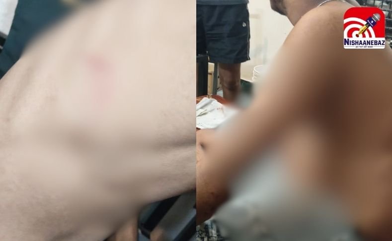 Ragging Case In RGPV : मुंह पर कपड़ा बांधकर जूनियर छात्रों से मारपीट…