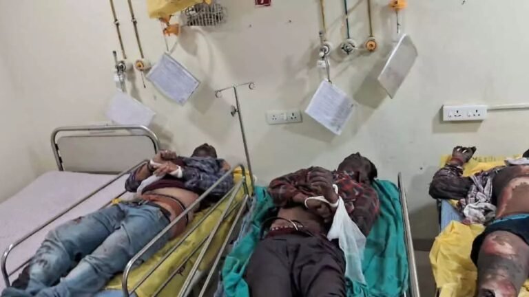 CG News : सिलतरा हादसा : गोदावरी पावर इस्पात हादसे के बाद औद्योगिक क्षेत्र में दहशत, मजदूरों ने काम बंद करने की चेतावनी दी