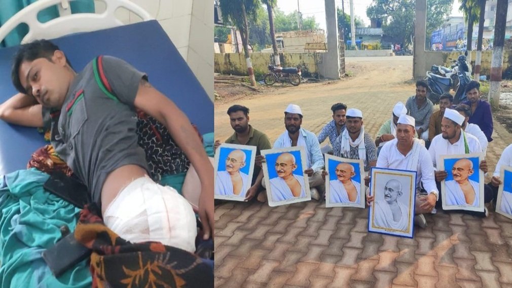 CG NEWS : थाना प्रभारी पर बर्बरता का आरोप: लात मारने से फूटी शराब की बोतल, आदिवासी युवक गंभीर रूप से घायल