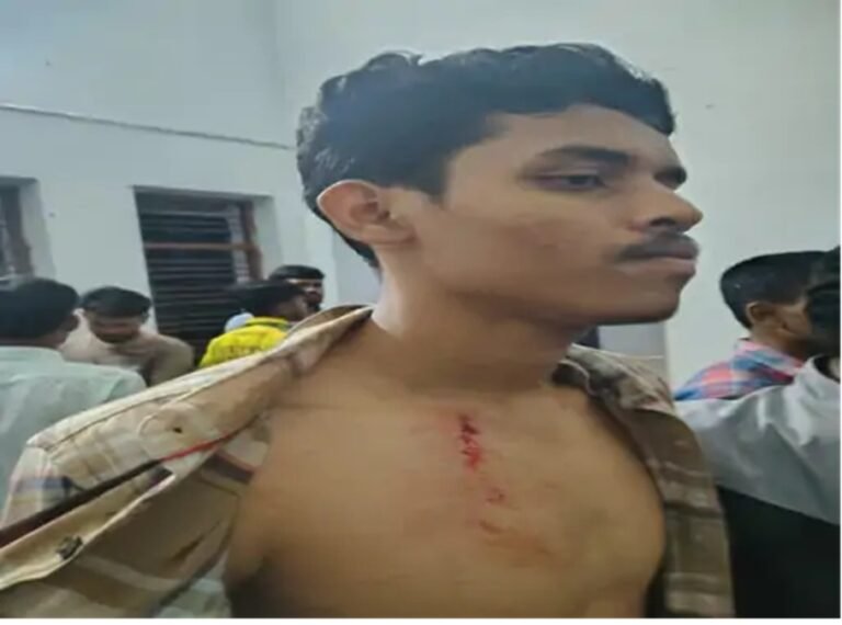 CG NEWS : रायपुर साइंस कॉलेज हॉस्टल में घुसकर छात्रों से मारपीट, मोबाइल लूटकर फरार हुए बाहरी युवक