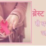 CG Breast Cancer