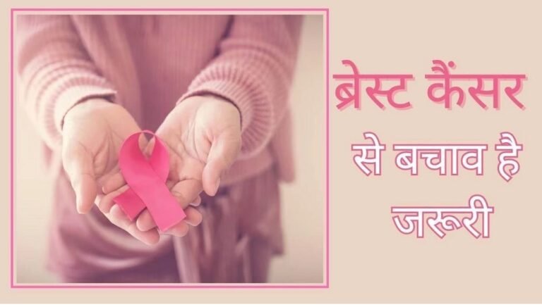 CG Breast Cancer