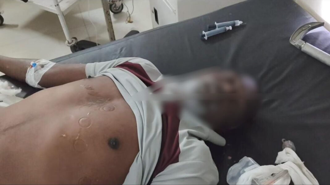 Singrauli News : जिला जेल में कैदी की मौत, परिजनों ने अस्पताल में हंगामा किया