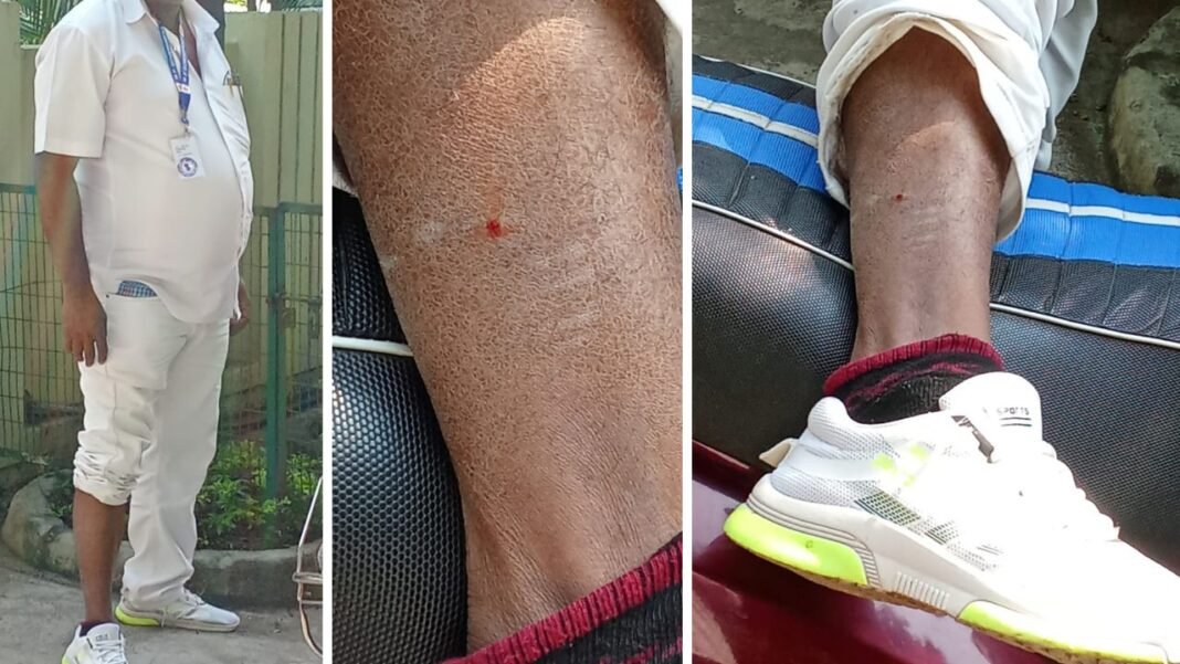 Dog Bite : गणना पत्रक देने गए बीएलओ पर श्वान का हमला, राजधानी में डॉग बाइट की घटनाएं बेकाबू