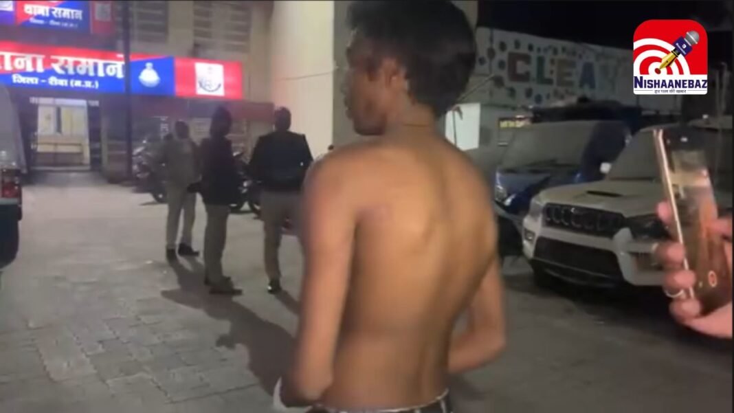 childhood friend held hostage : बचपन के साथी ने युवक को बनाया बंधक, बेरहमी से पिटाई; मां का आरोप- पुलिस कर रही समझौते का दबाव