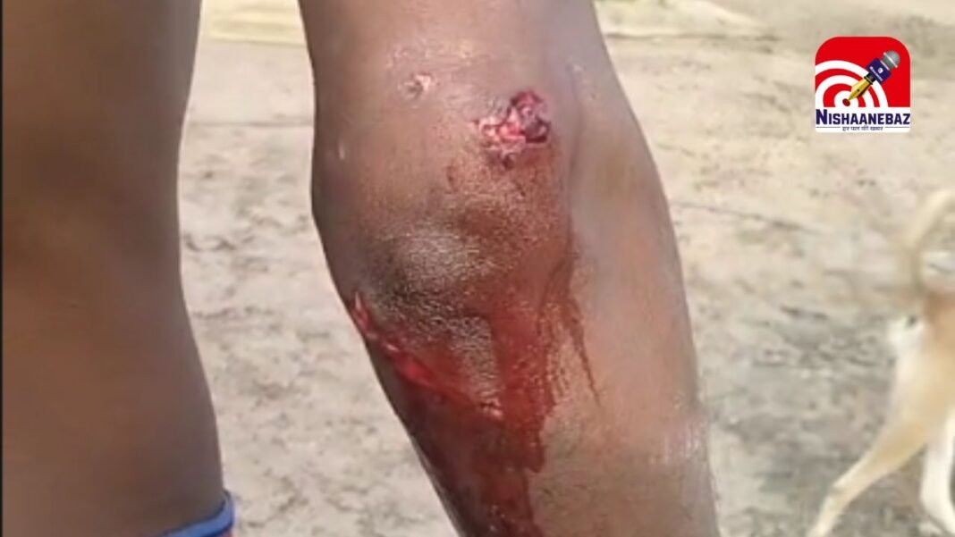 Leopard attack : सिंचाई के लिए खेत गया कर्मचारी तेंदुए के हमले से गंभीर घायल; कटंगी क्षेत्र में दहशत