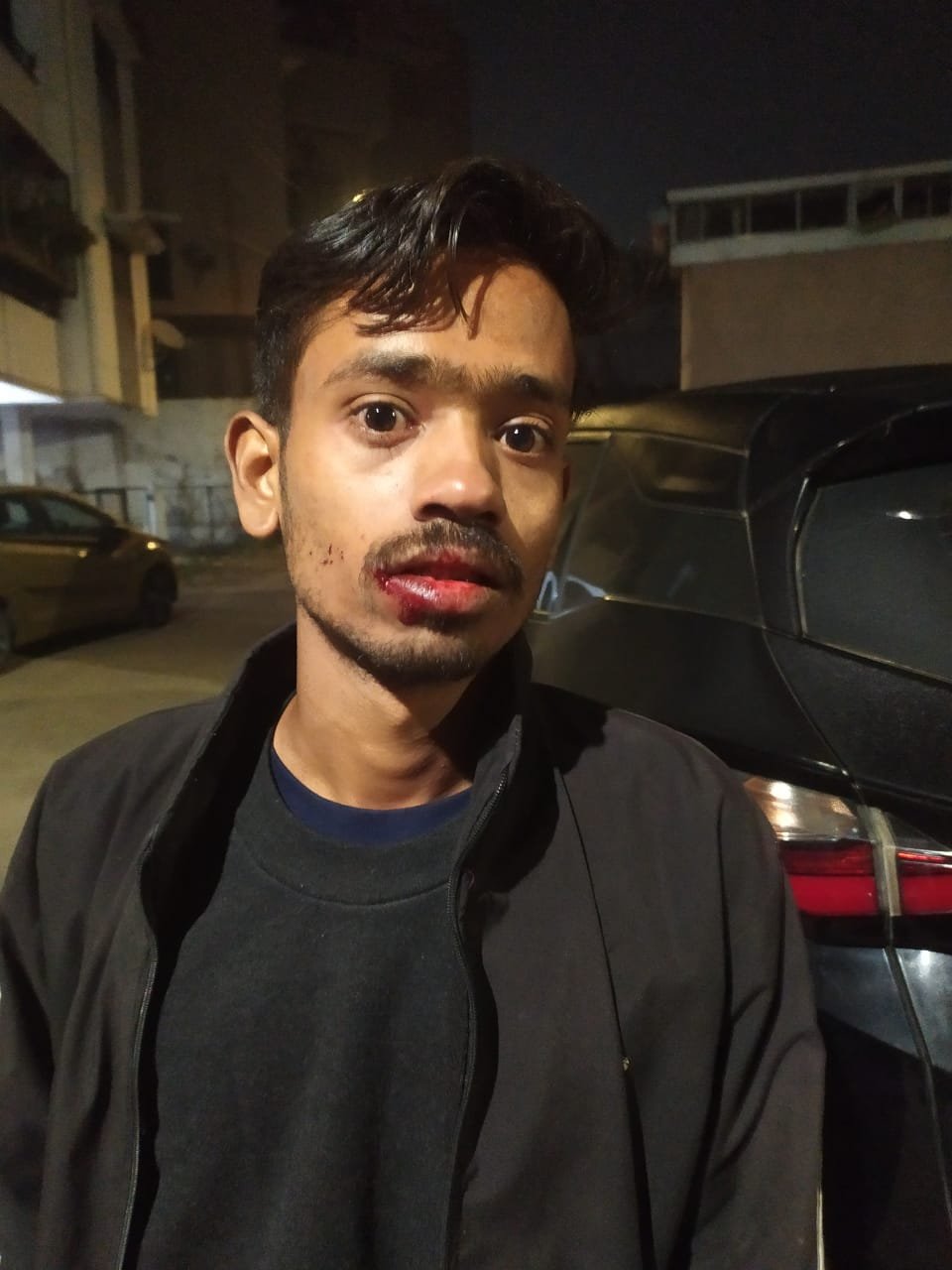 Golden Palace Township : गोल्डन पैलेस टाउनशिप में चौकीदार से बेरहमी से मारपीट, वीडियो वायरल होने के बाद आरोपी पर केस दर्ज