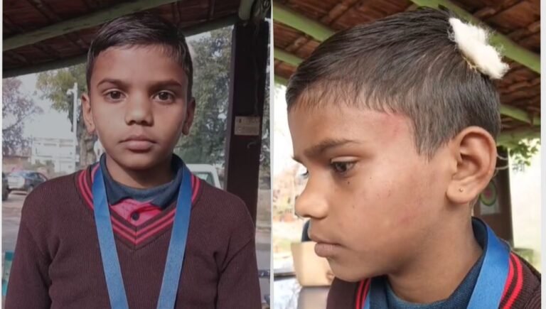 M.P News : होमवर्क न करने पर हैवान बनी शिक्षिका! रीवा में 5वीं के छात्र की बेरहमी से पिटाई, देखें Video