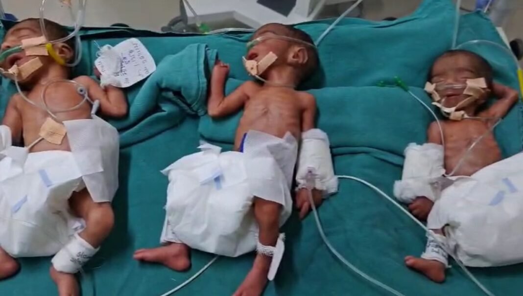 M.P News : रीवा में चमत्कारी मामला! महिला ने एक साथ दिया तीन बच्चों को जन्म