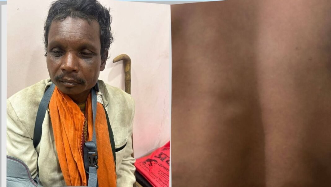 M.P Crime : सिंगरौली में आदिवासियों पर वन विभाग की बर्बरता का आरोप, पिटाई का Video वायरल, जीतू पटवारी ने की FIR की मांग