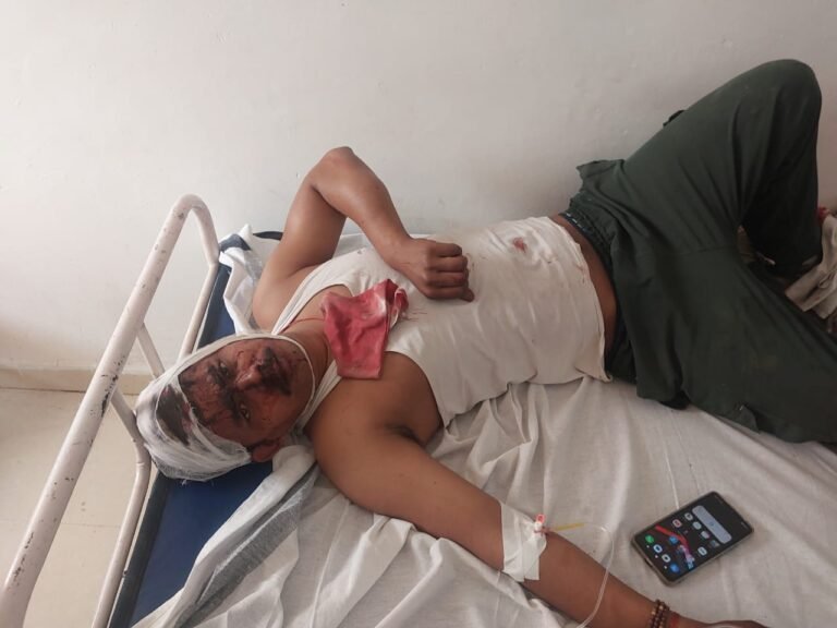 Baikunthpur Group Clash : रीवा ब्रेकिंग: नगर परिषद क्षेत्र में जमकर चली लाठियां, मारपीट में आधा दर्जन घायल, अस्पताल में भर्ती