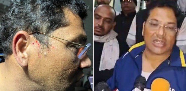 Baidhan Assault Case : सिंगरौली पुलिस का ‘इनामी’ एक्शन: बैढ़न मारपीट के आरोपी सत्यम सिंह पर ₹10 हजार का इनाम घोषित