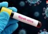 Nipah Virus ने फिर बढ़ाई टेंशन! जानें इसके कैसे फैलता है और क्या हैं इसके लक्षण