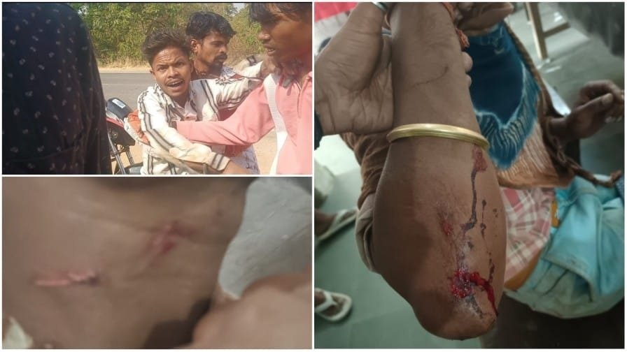 CG NEWS : लैलूंगा में गुंडागर्दी का तांडव : महिलाओं के सम्मान में आवाज उठाना पड़ा भारी, दबंगों ने सरेराह भाइयों को लहूलुहान किया ; FIR दर्ज…