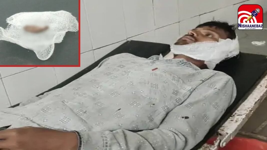 Girar Police Station Lalitpur : ललितपुर में नशेड़ी ने दांत से काटकर अलग किया युवक का कान, हाथ में लेकर थाने पहुंचा पीड़ित