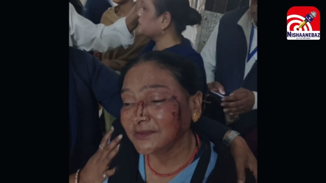 Gwalior Hospital Security Guard Assault : ग्वालियर के कमलाराजा अस्पताल में महिला गार्ड से मारपीट: आरोपी अजय राजोरिया गिरफ्तार