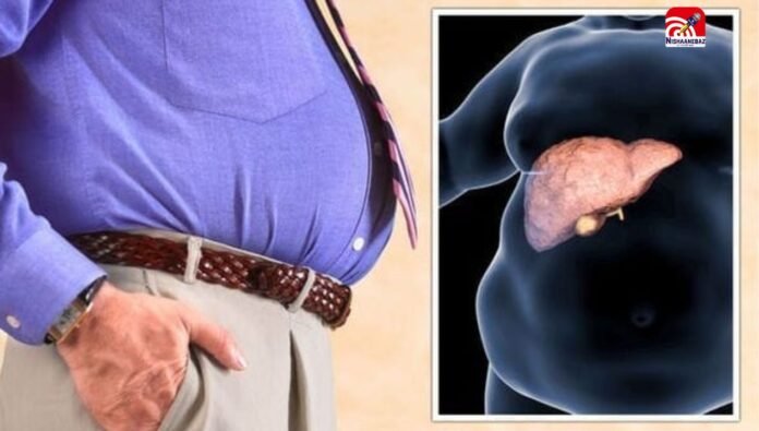 fatty liver