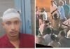 CG CRIME : शादी समारोह में हिंसा, लाठी-डंडों और बेल्ट से हमला, पांच घायल CG CRIME