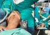 CG NEWS : सिम्स में चमत्कार: 5 साल के बच्चे के गले से एंडोस्कोपी से निकाला सिक्का, बची जान CG NEWS
