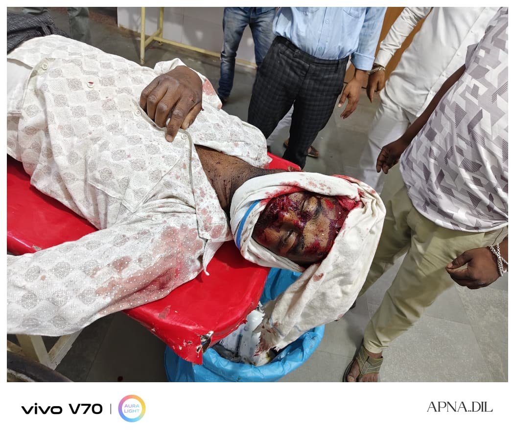 Shajapur Road Accident : शाजापुर: मदाना जोड़ पर ट्रैक्टर-ट्रॉली में घुसी तेज रफ्तार बाइक; भीषण हादसे में युवक गंभीर रूप से घायल