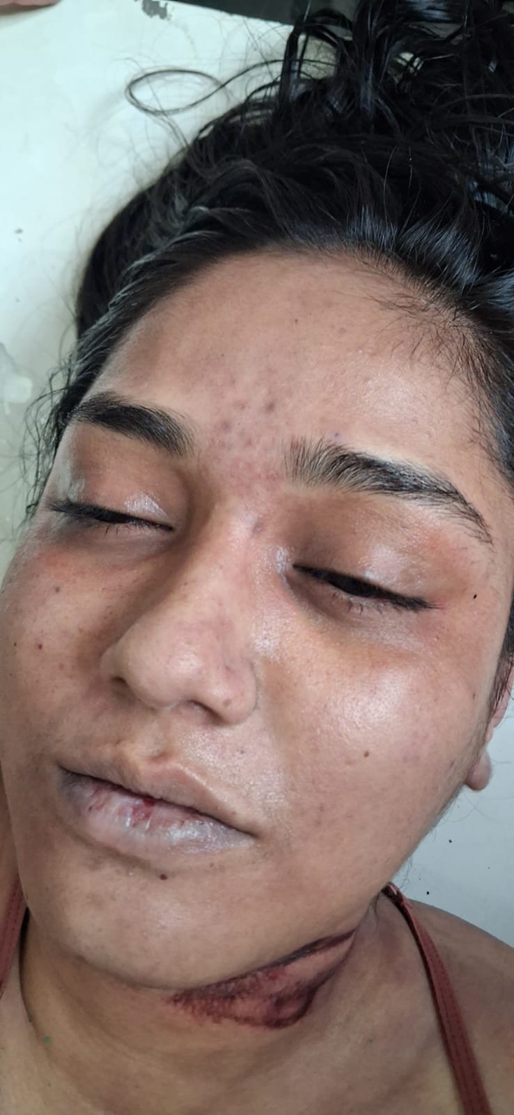 MP NEWS: भोपाल में रिटायर्ड जज की बहू ने लगाई फांसी, मायके पक्ष ने पति पर प्रताड़ना का लगाया आरोप