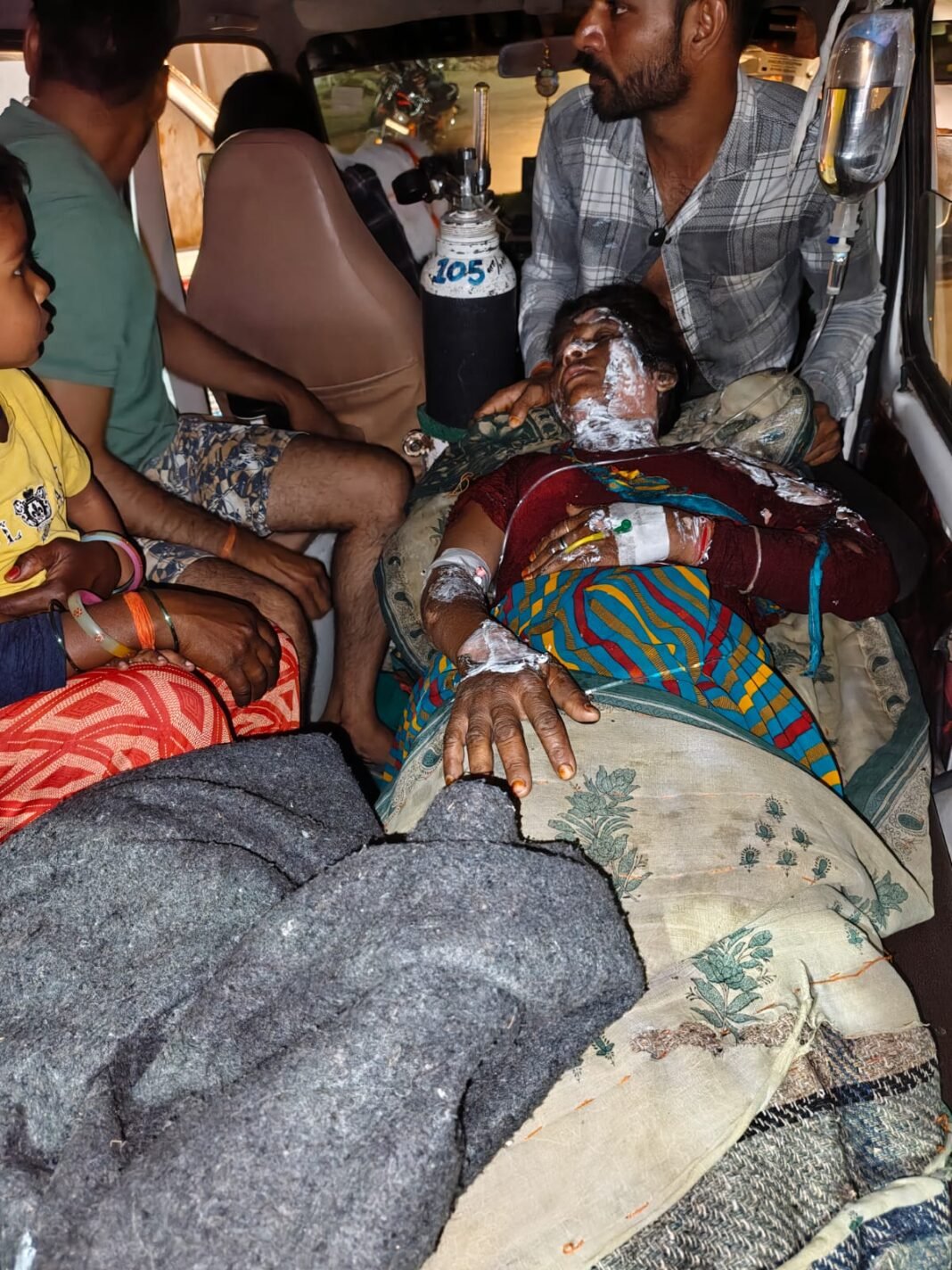 Bhitwar Crime News : भितरवार: देवर ने भाभी पर पेट्रोल डालकर लगाई आग; महिला गंभीर रूप से झुलसी, आरोपी पर केस दर्ज