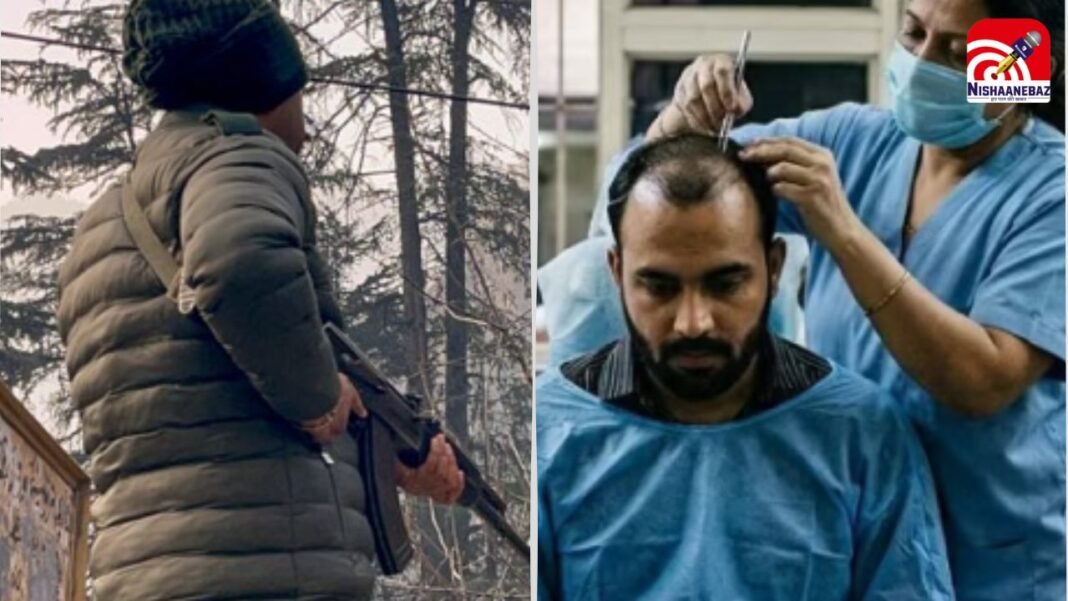 आतंक फैलाने पाकिस्तान से आया इंडिया! बाल झड़ने से परेशान आतंकी पहुंचा हेयर ट्रांसप्लांट कराने, NIA भी हैरान