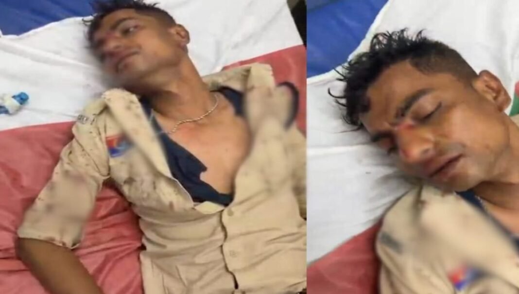 Bilaspur Crime News: बिलासपुर में बदमाशों के हौसले बुलंद, डायल-112 के आरक्षक मोरज सिंह पर डंडे से हमला