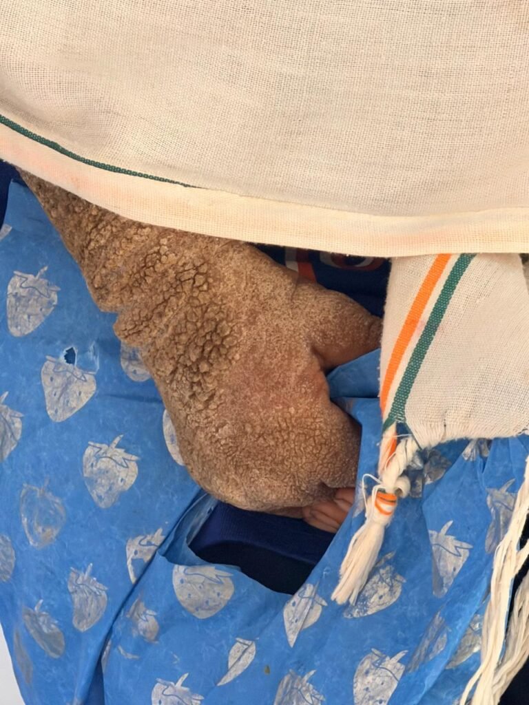 CG Child Rights Commission: डॉ. वर्णिका शर्मा की पहल रंग लाई, दंतेवाड़ा की गंभीर बीमार बेटी का एम्स में इलाज शुरू