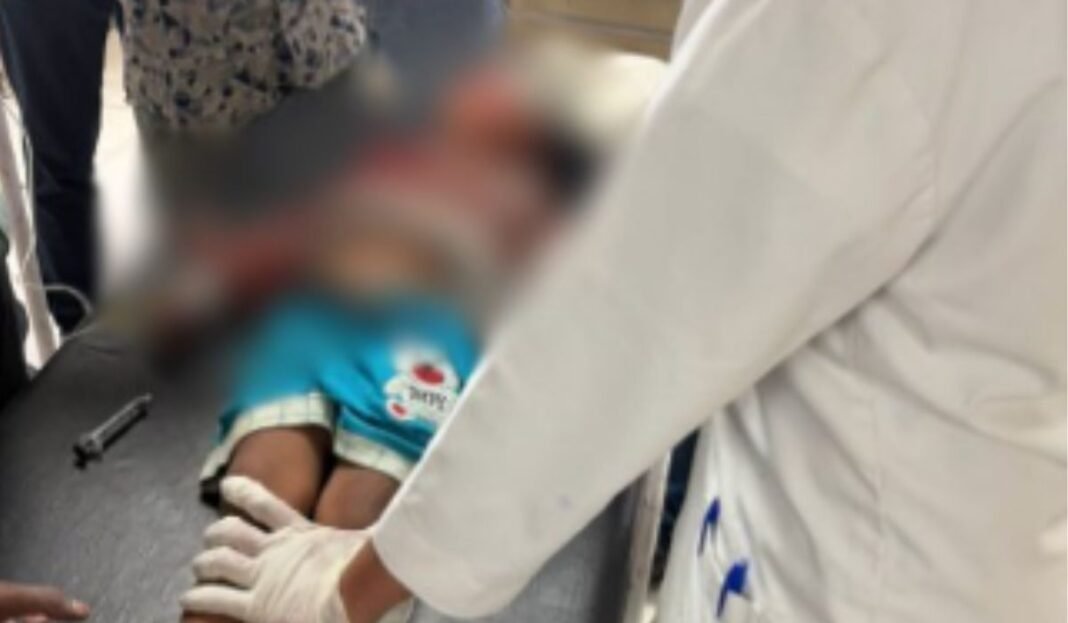 MP Stray Dog Attack on Toddler: आवारा कुत्ते के हमले से 3 साल की मासूम गंभीर घायल, चेहरे पर लगे 55 टांके; बेहतर इलाज के लिए इंदौर रेफर