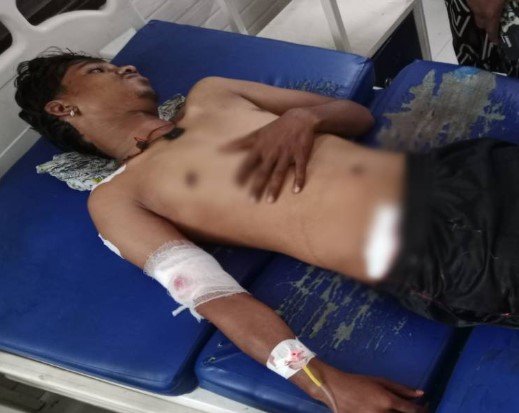 Dhamtari Crime: पुरानी रंजिश में चाकूबाजी: दिनदहाड़े युवक पर ताबड़तोड़ वार, एक आरोपी गिरफ्तार, दूसरे की तलाश Dhamtari Crime