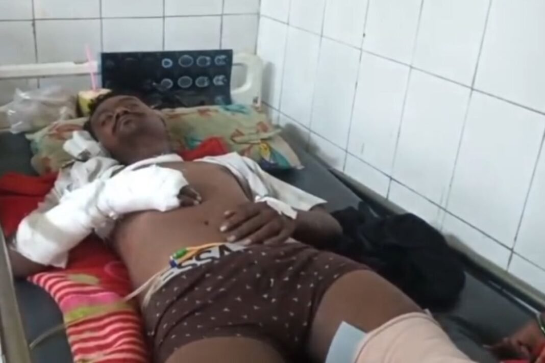 Gwalior Crime News: गिरफ्तारी के दौरान दूसरी मंजिल से गिरा 11 मामलों का फरार आरोपी, पुलिस बोली- भागते समय गिरा; आरोपी का आरोप- धक्का दिया Gwalior Crime News: गिरफ्तारी के दौरान दूसरी मंजिल से गिरा 11 मामलों का फरार आरोपी, पुलिस बोली- भागते समय गिरा; आरोपी का आरोप- धक्का दिया