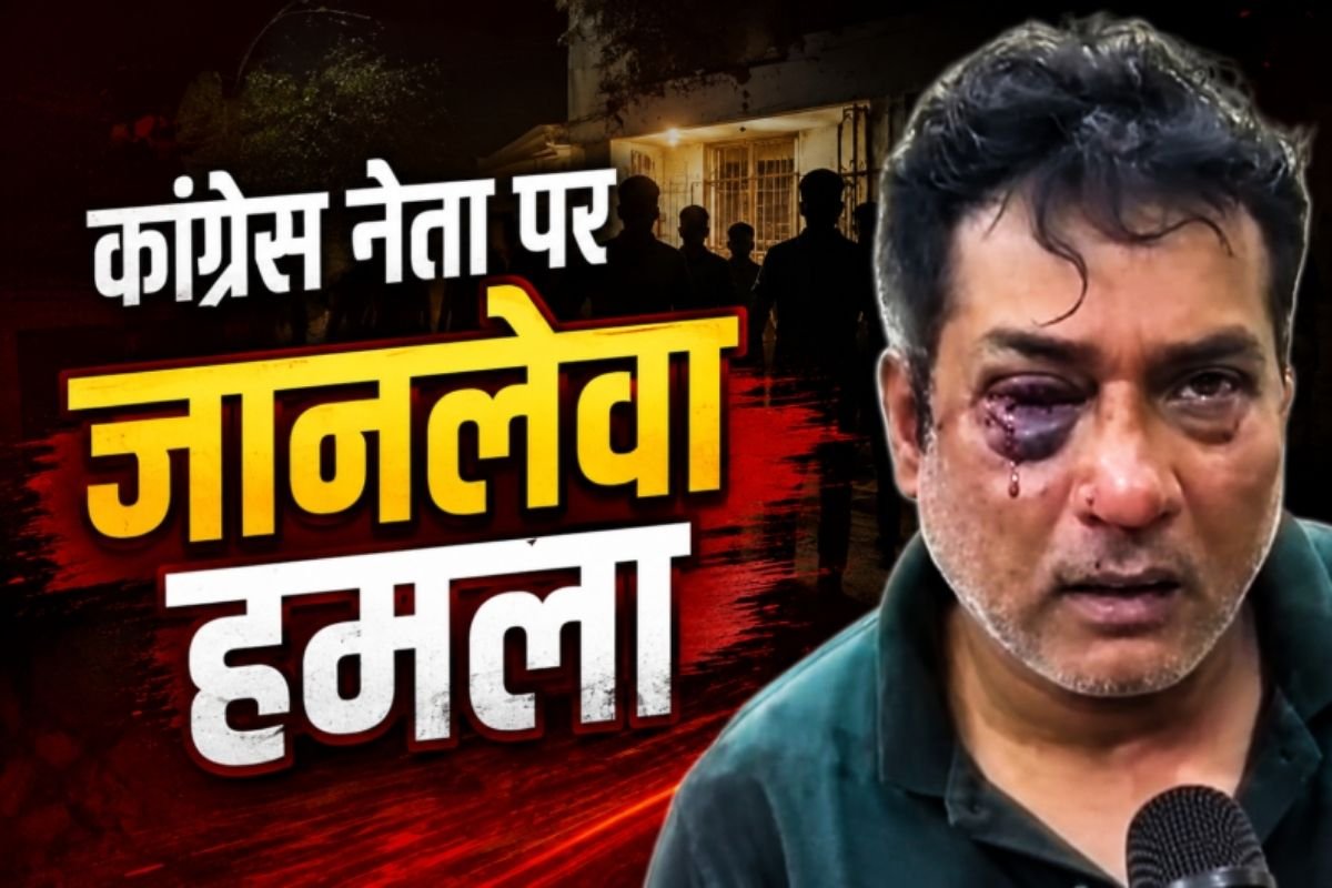 Ambikapur Political Clash: पूर्व डिप्टी सीएम टीएस सिंहदेव के करीबी सिद्धू गंभीर घायल, आंख में आई चोट; अस्पताल में भर्ती