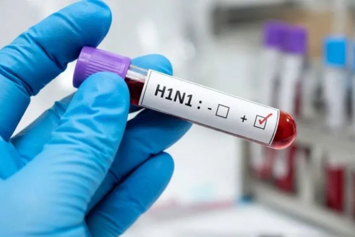 Chhattisgarh Swine Flu Alert H1N1 Active Cases: छत्तीसगढ़ में स्वाइन फ्लू को लेकर अलर्ट जारी, प्रदेश में 31 मरीज एक्टिव; सभी CMHO को कड़े निर्देश
