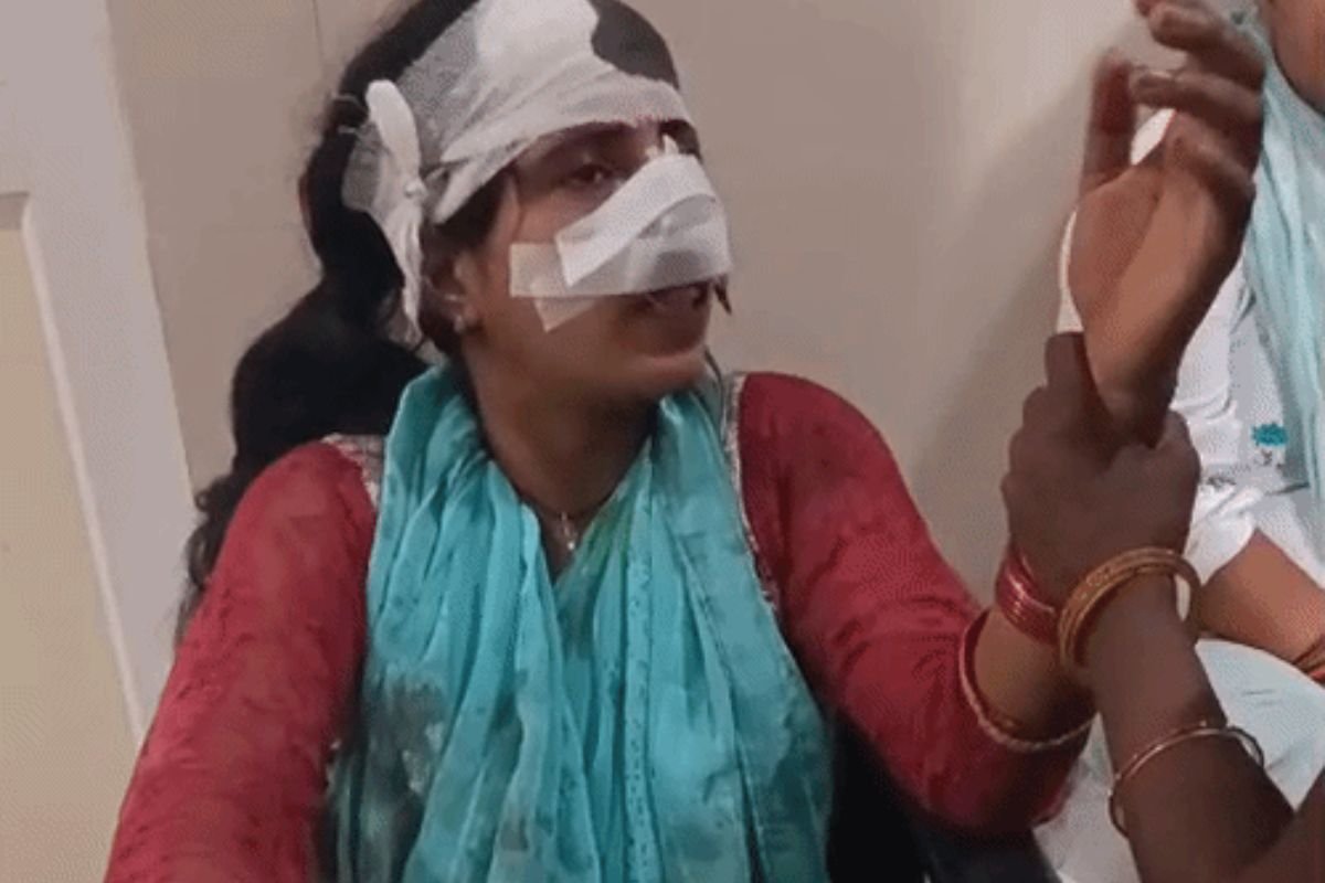 Hardoi Domestic Violence Case: हरदोई में पति-पत्नी के विवाद में खूनी खेल, पति पर नाक काटने तो महिला पर गंभीर आरोप