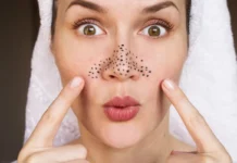 Skin Care: बार-बार हो रहे ब्लैकहेड्स? ये गलती पड़ सकती है भारी, जानें पोर्स की सफाई का सही तरीका