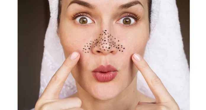 pORE_sKIN