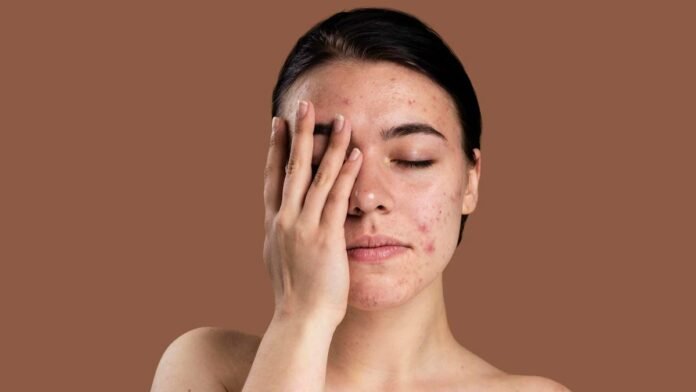 sensitive-skin-products
