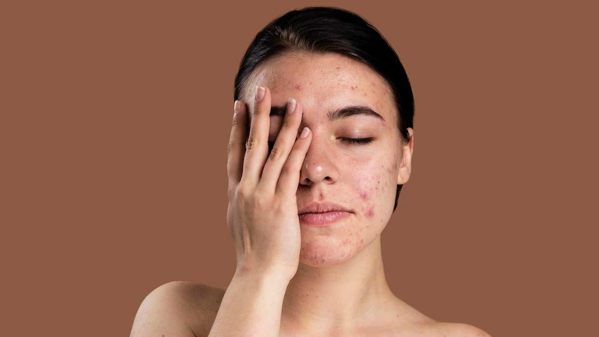 Skin Care: चेहरे का ग्लो कम कर सकती हैं ये 5 आदतें, कहीं आप भी तो नहीं कर रहे ये गलती?