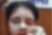 Balod News: पुलिसकर्मी की बेटी पर एसिड अटैक, लाइब्रेरी से लौटते समय युवक ने किया हमला Balod News