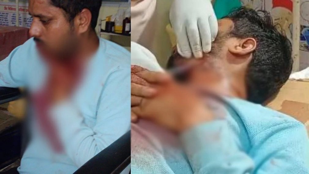Mahasamund News:आपसी विवाद में चाकूबाजी, अस्पताल संचालक की गर्दन पर किए तीन वार; भाजपा नेता समेत 3 गिरफ्तार