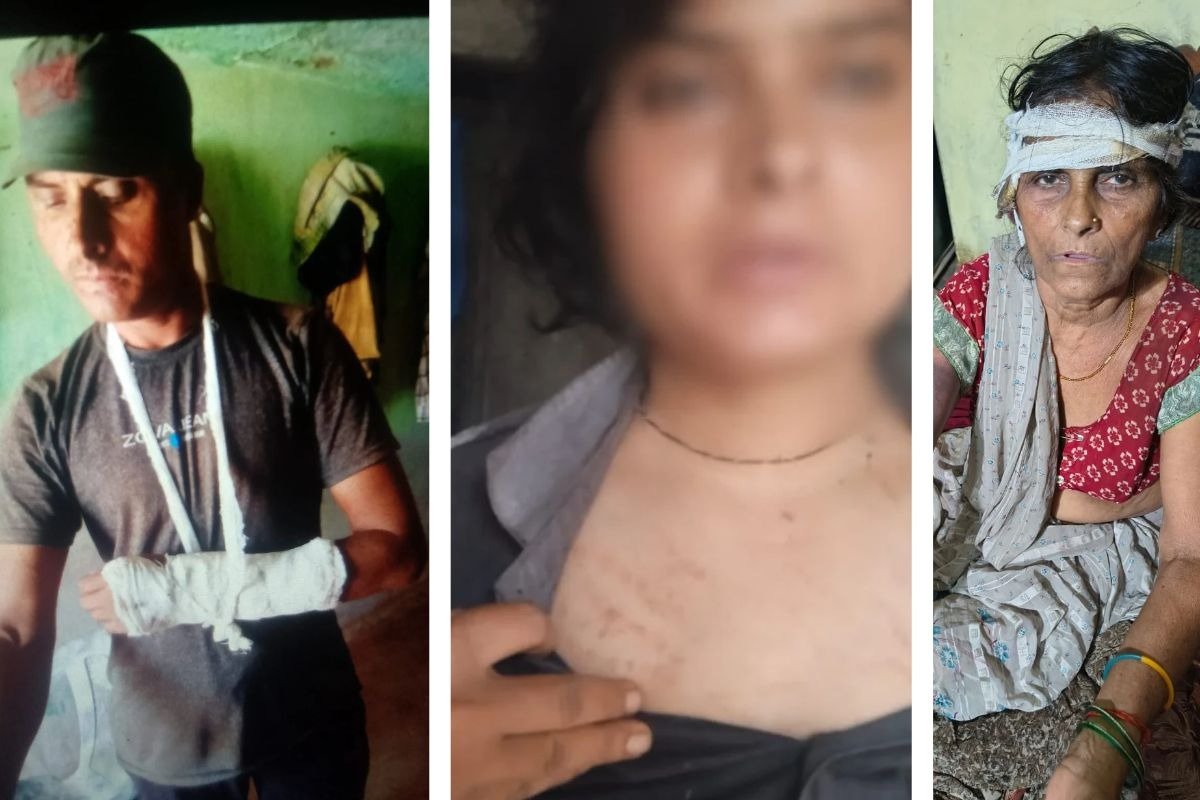 Rewa Molestation Violence: रीवा में युवती से छेड़छाड़ का विरोध करने पर परिजनों पर हमला, मां पर कुल्हाड़ी से वार
